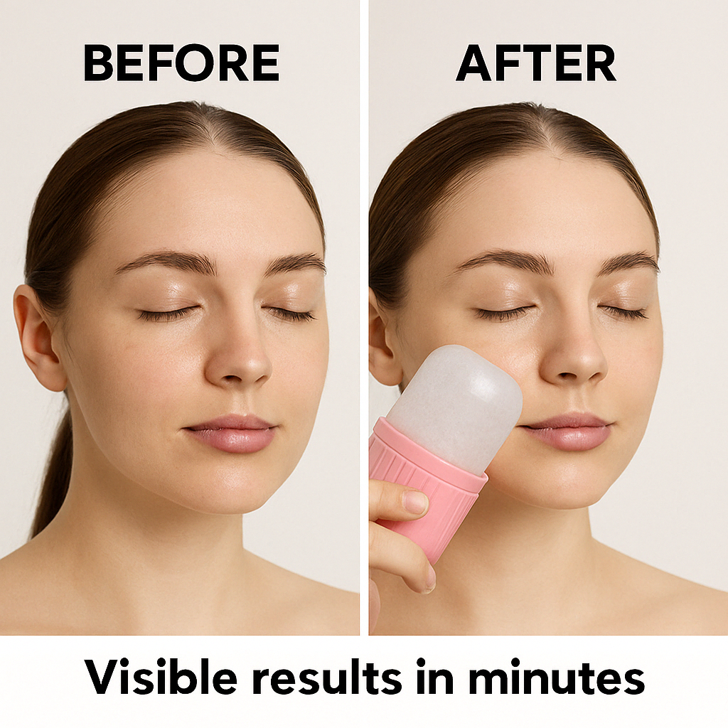 DIVARA™-Ice Face Roller